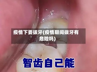 疫情下要拔牙(疫情期间拨牙有危险吗)