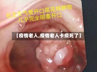 【疫情老人,疫情老人卡痰死了】