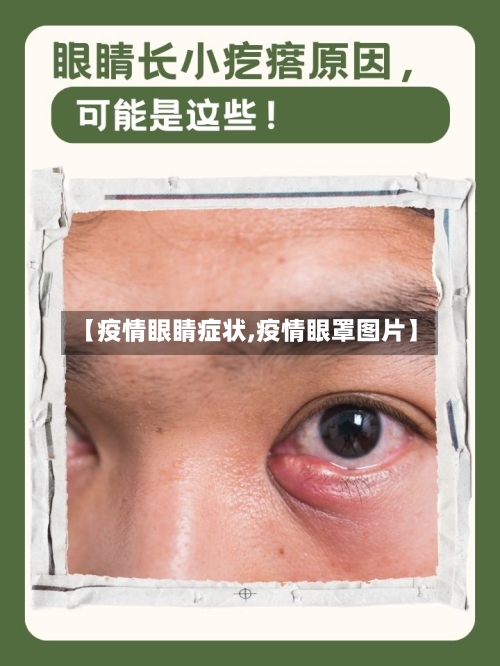 【疫情眼睛症状,疫情眼罩图片】-第1张图片