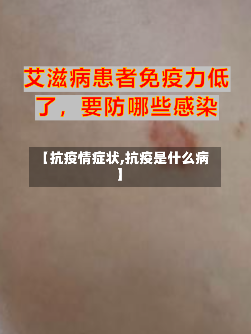 【抗疫情症状,抗疫是什么病】-第2张图片