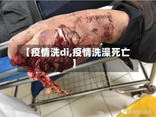 【疫情洗di,疫情洗澡死亡】-第2张图片