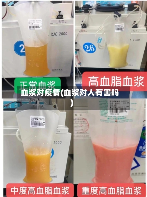 血浆对疫情(血浆对人有害吗)-第3张图片