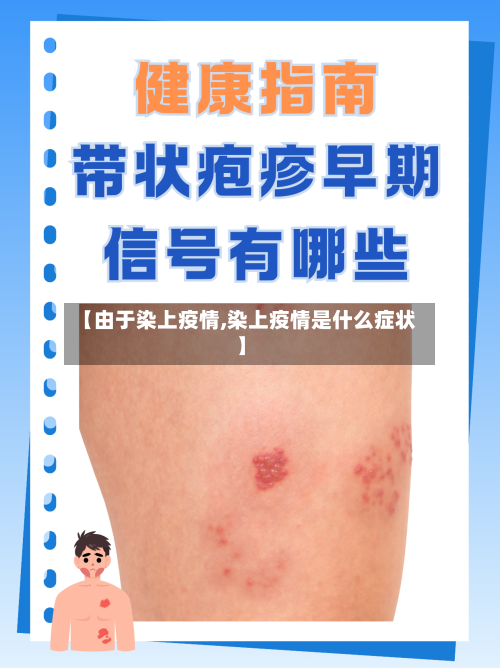 【由于染上疫情,染上疫情是什么症状】-第1张图片