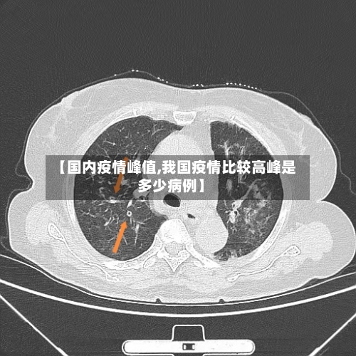 【国内疫情峰值,我国疫情比较高峰是多少病例】-第1张图片