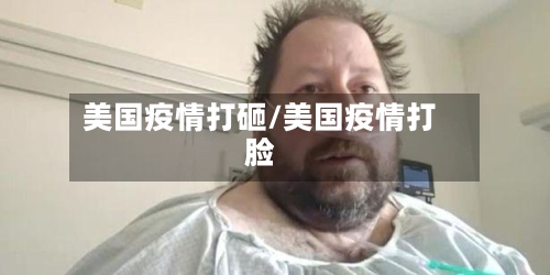 美国疫情打砸/美国疫情打脸-第1张图片